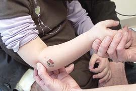 一岁半的宝宝肘关节脱位了怎么办,宝宝肘关节半脱位会影响今后吗