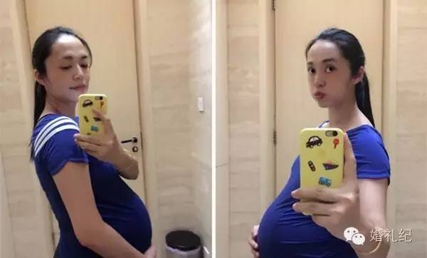 怀孕脸上长斑生完孩子会下去吗,怀孕脸上会长斑怎么办