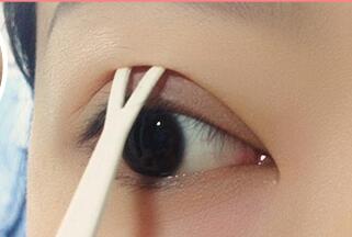 儿童双眼皮贴正确的贴法,单眼皮双眼皮贴正确的贴法