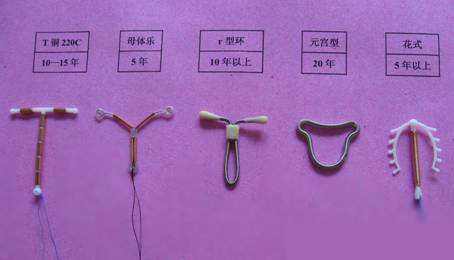 取环14天后劳累腰疼是怎么回事,取环后腰疼是什么原因导致的