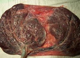 胎盘到底要还是不要呢,胎盘真的有奇效吗