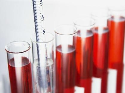 尿液发红是咋回事?发现血尿怎么办?