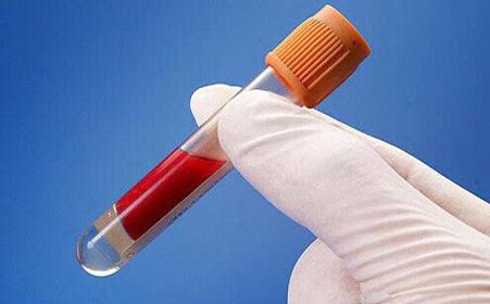 出现六种症状警惕白血病可以预防吗？