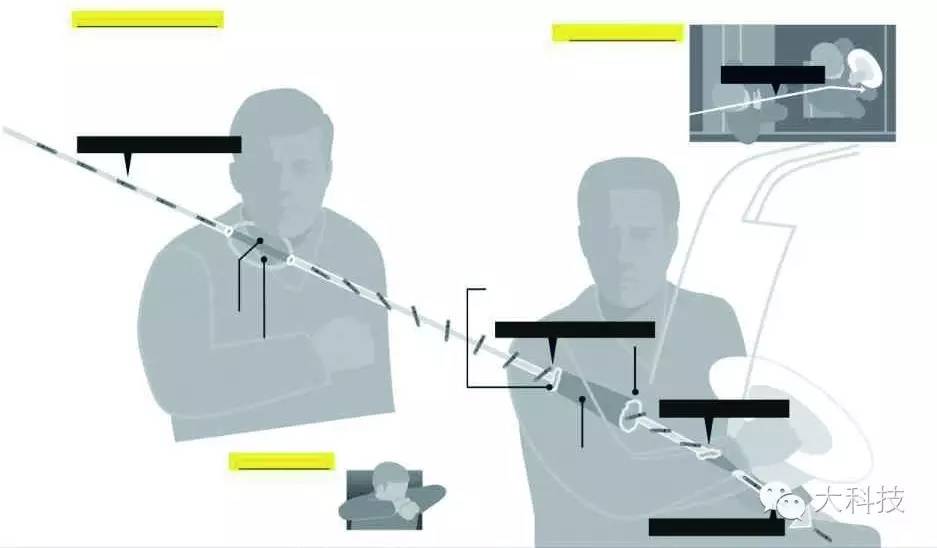 可以跳的弹珠,暴跳的弹珠