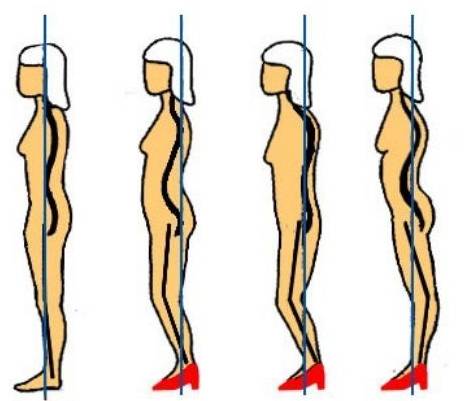 20厘米高跟鞋训练方法,高跟鞋矫正训练方法有哪些