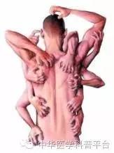 痒痒难受且看小手套大学问