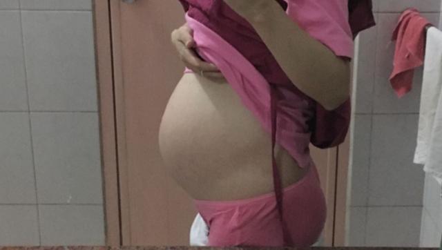 妇产科医生告诉你孕肚长毛，是否生男孩子！