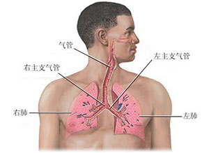 过敏性喘息性支气管炎严重后果,过敏性支气管炎严重吗