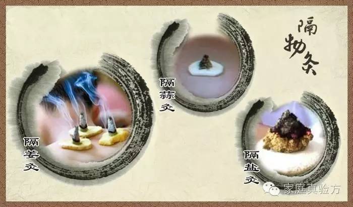 宫寒不孕艾灸穴道,宫寒痛经怎么艾灸