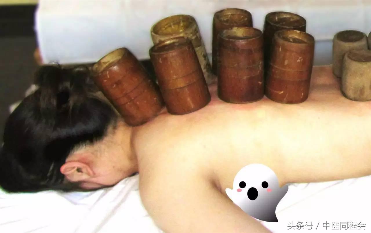 正中堂,专业的艾灸中医馆