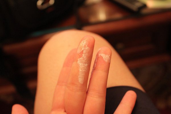 如何去除皮肤、地板和衣服上的强力胶?