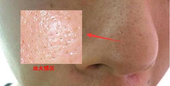 老赖死皮赖脸,老赖欠薪跑路怎么办