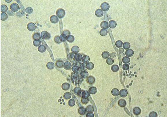 宝宝口腔里有白色奶块还酸味,宝宝口腔里有白色奶状物