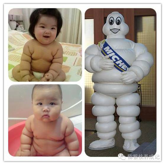 大腿纹不对称图片大全,新生儿大腿皮纹不对称怎么办