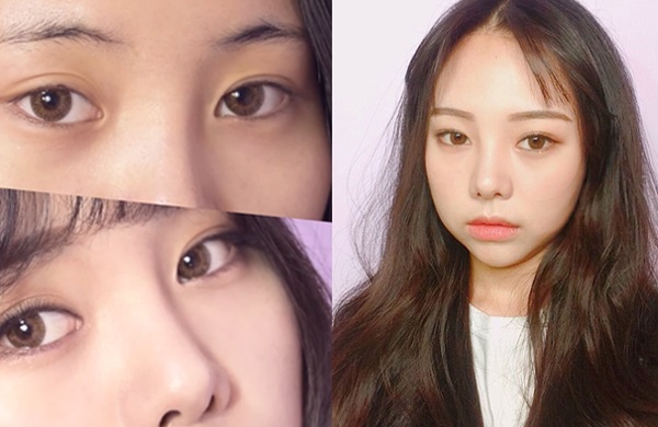 天生塌鼻梁矫正方法,天生塌鼻梁怎么可以变低