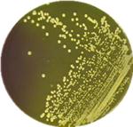 杀灭金黄葡萄球菌的精油 (抑制金黄色葡萄球菌的精油)