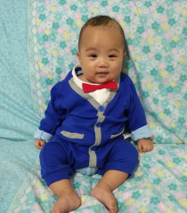 宝宝奶痂几个月才掉,一个月的宝宝长奶痂用什么治疗