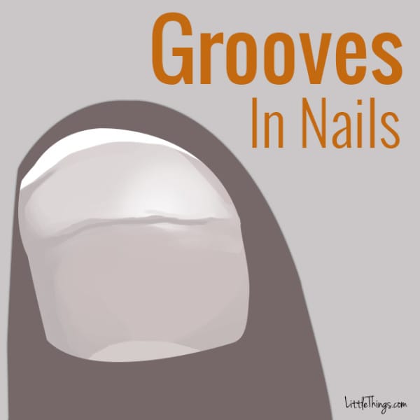 指甲健康的七种表现,指甲哪些变化需要警惕