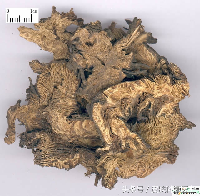 小儿口腔溃疡高烧有哪些偏方,十岁小孩口腔溃疡复发中医辨证