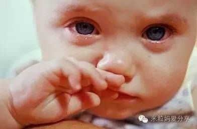 宝宝一直鼻塞又没感冒是怎么回事,三个月宝宝咳嗽鼻塞又发烧怎么办