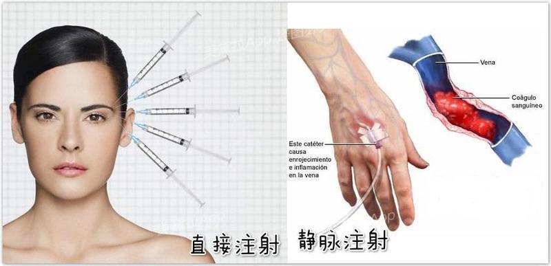 打美白针要知道哪些常识,打美白针要注意这些事项