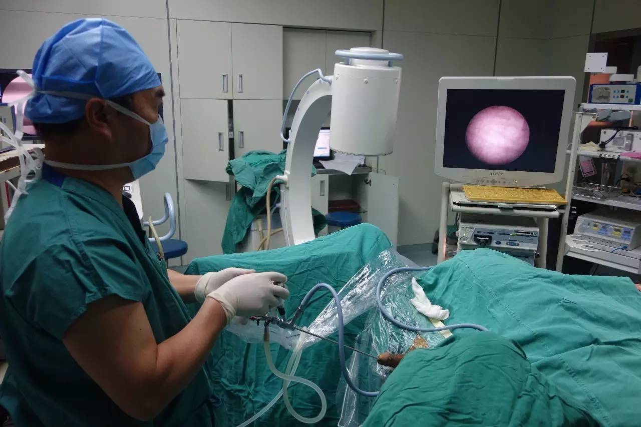 微创肾镜下肾结石碎石取石术,经皮肾镜肾结石激光碎石全过程