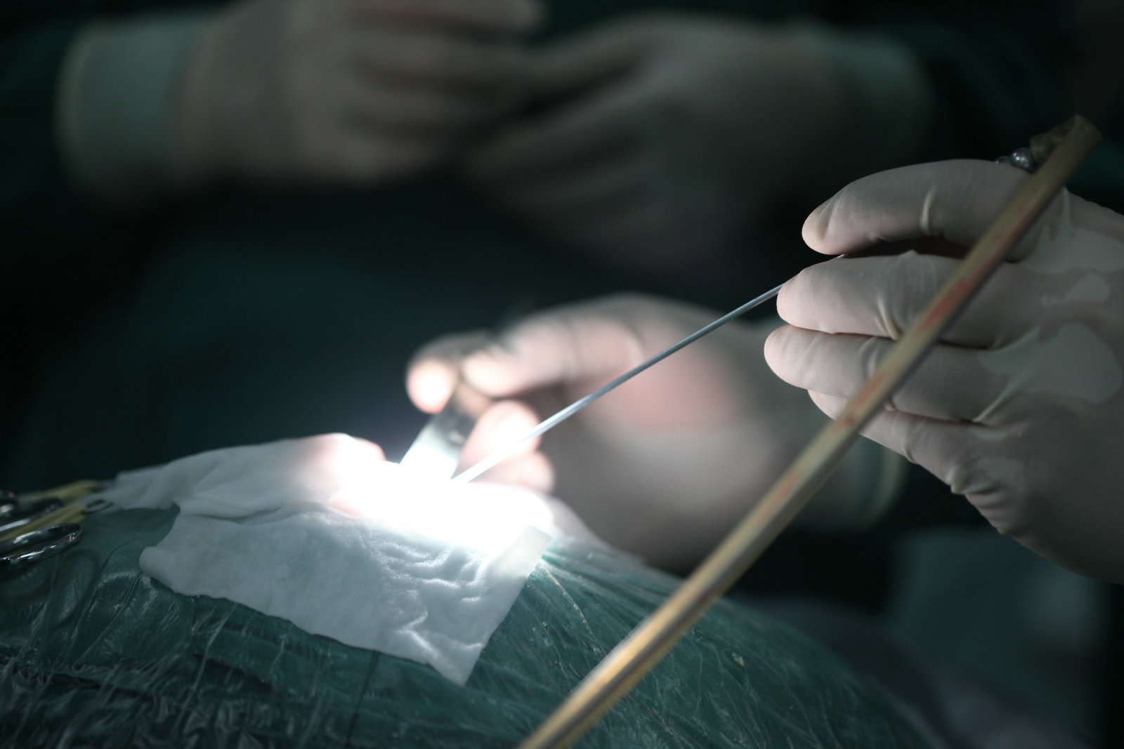 神经外科纪实视频,显微神经外科手术费用