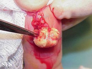 程序猿:你被盯上了!