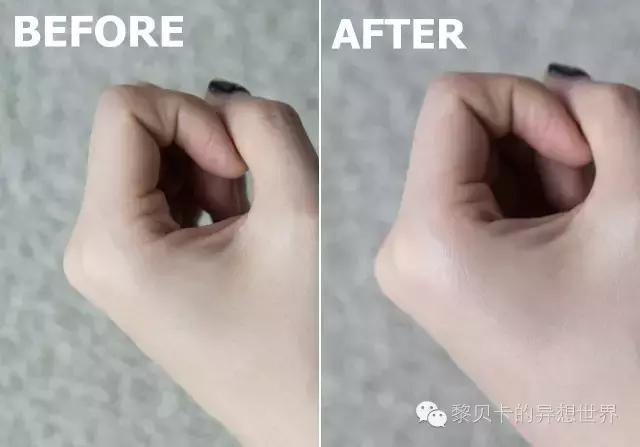 熬夜皮肤干燥缺水如何快速恢复,熬夜皮肤干燥起皮怎么办