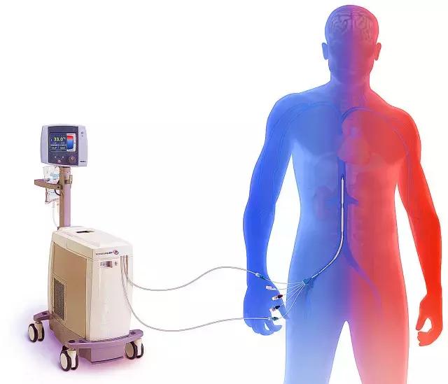 脑复苏低温疗法护理措施哪项错误,心脏骤停10小时抢救技术突破