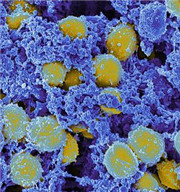 杀灭金黄葡萄球菌的精油 (抑制金黄色葡萄球菌的精油)