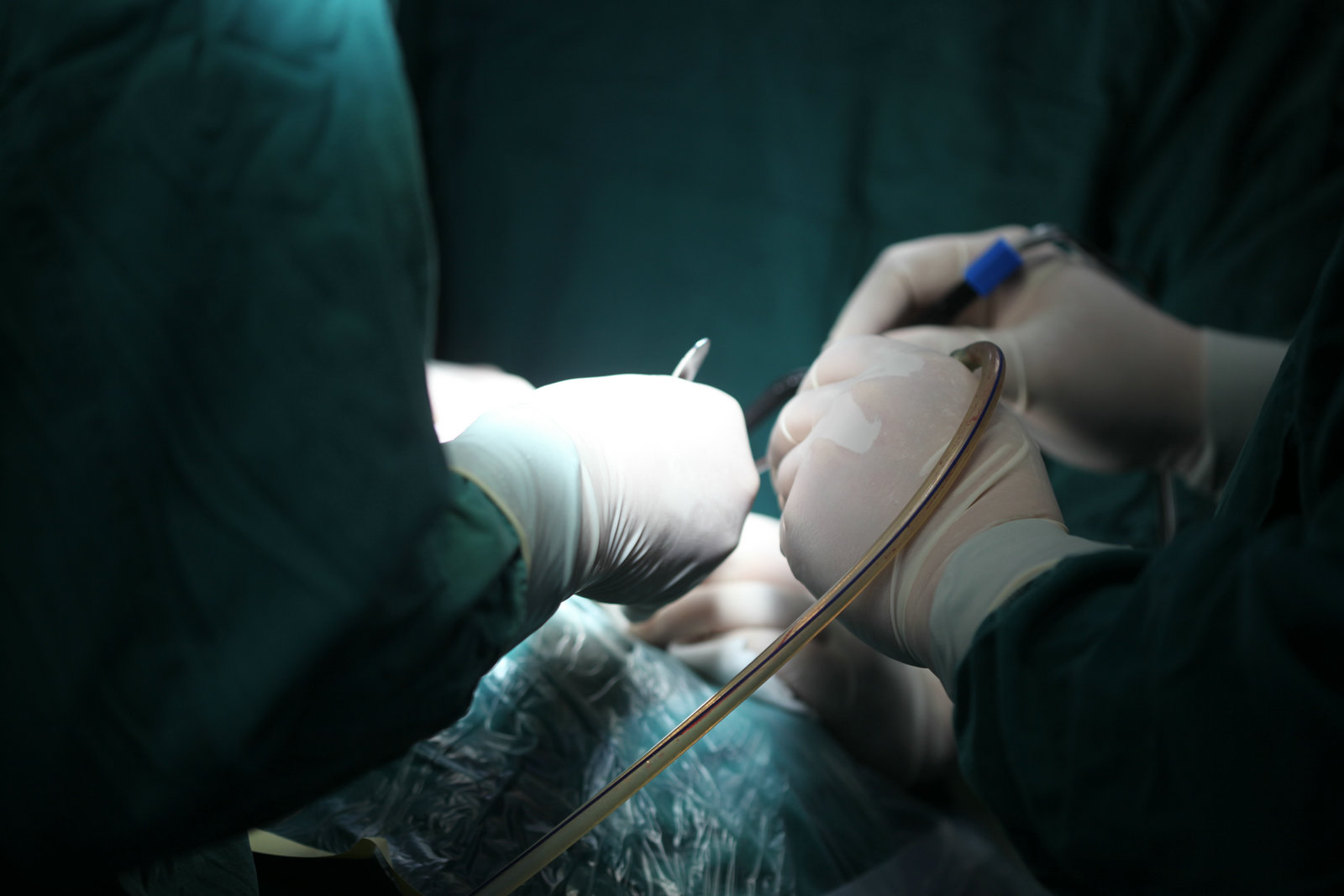 神经外科纪实视频,显微神经外科手术费用