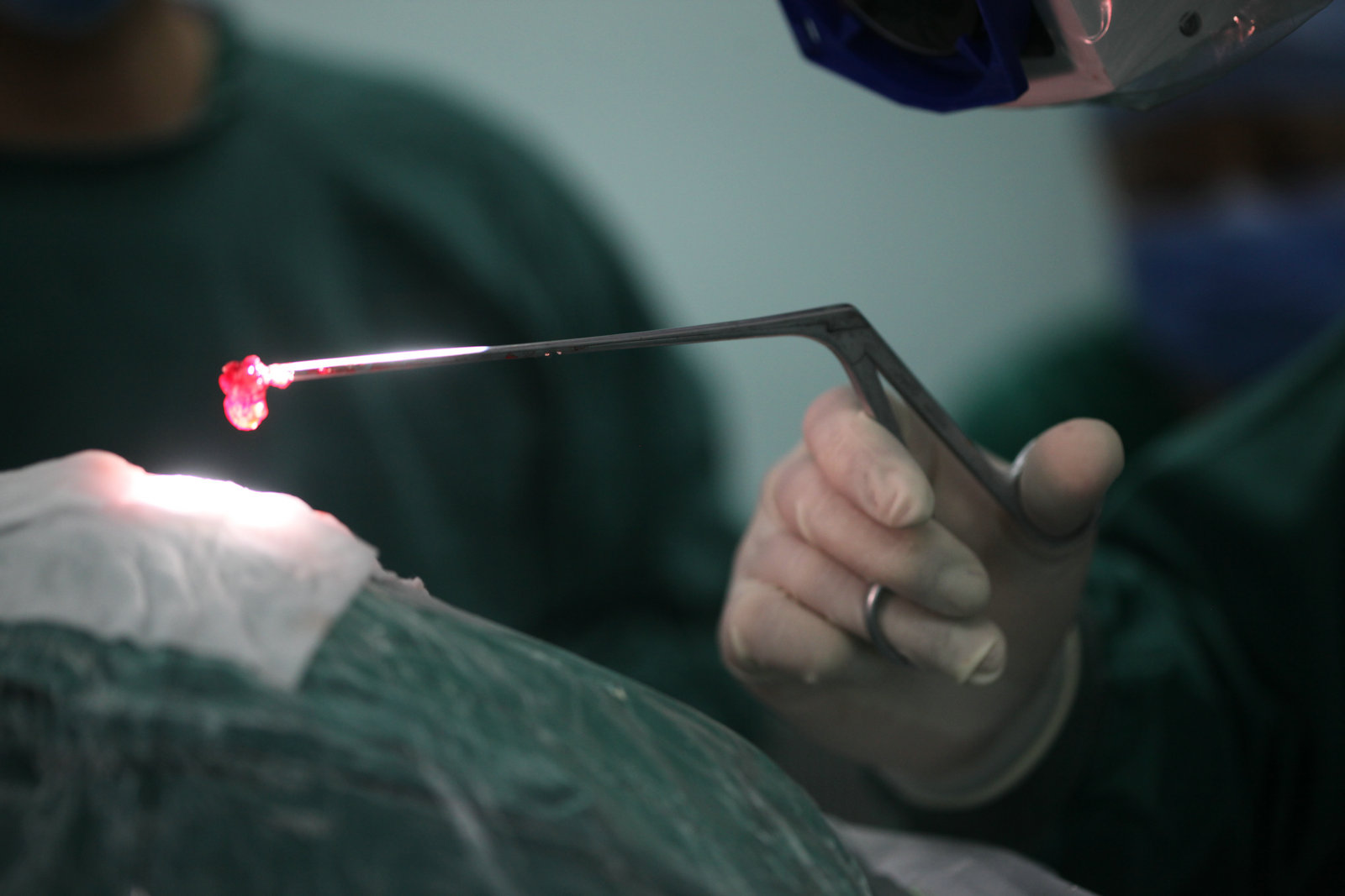 神经外科纪实视频,显微神经外科手术费用