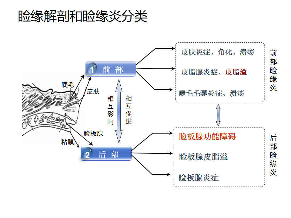 眼睑缘炎的发病原因,眼睑炎的症状和治疗方法