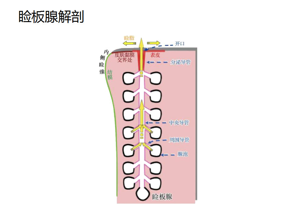 眼睑缘炎的发病原因,眼睑炎的症状和治疗方法