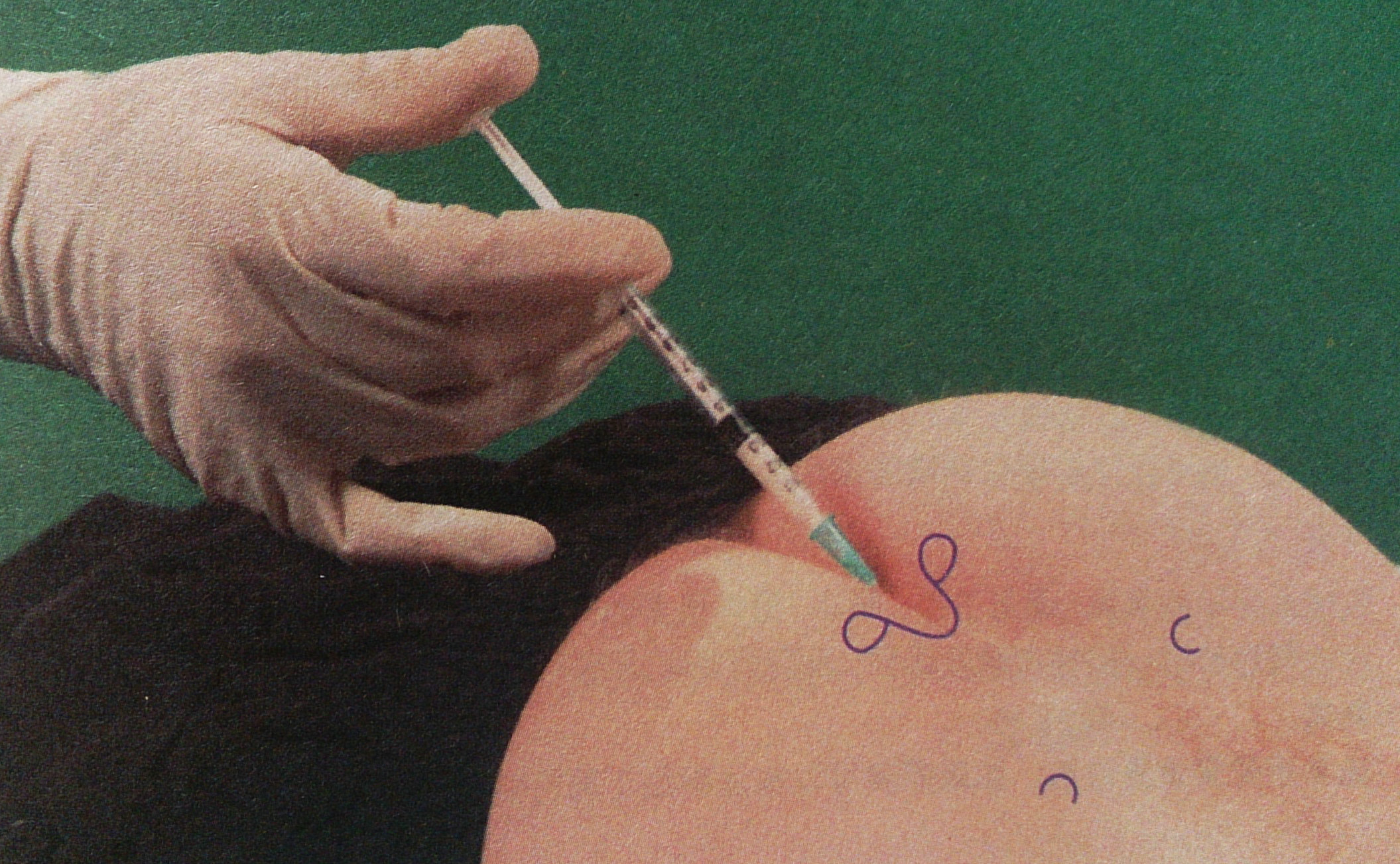 高龄老年腰腿痛患者可以尝试的一种无创疗法