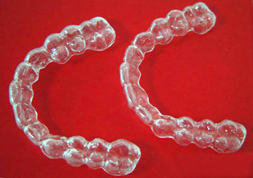 天津牙齿矫正保持器怎么样,牙齿矫正后要戴保持器多久