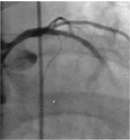 刘燕中西医结合,刘燕catherine