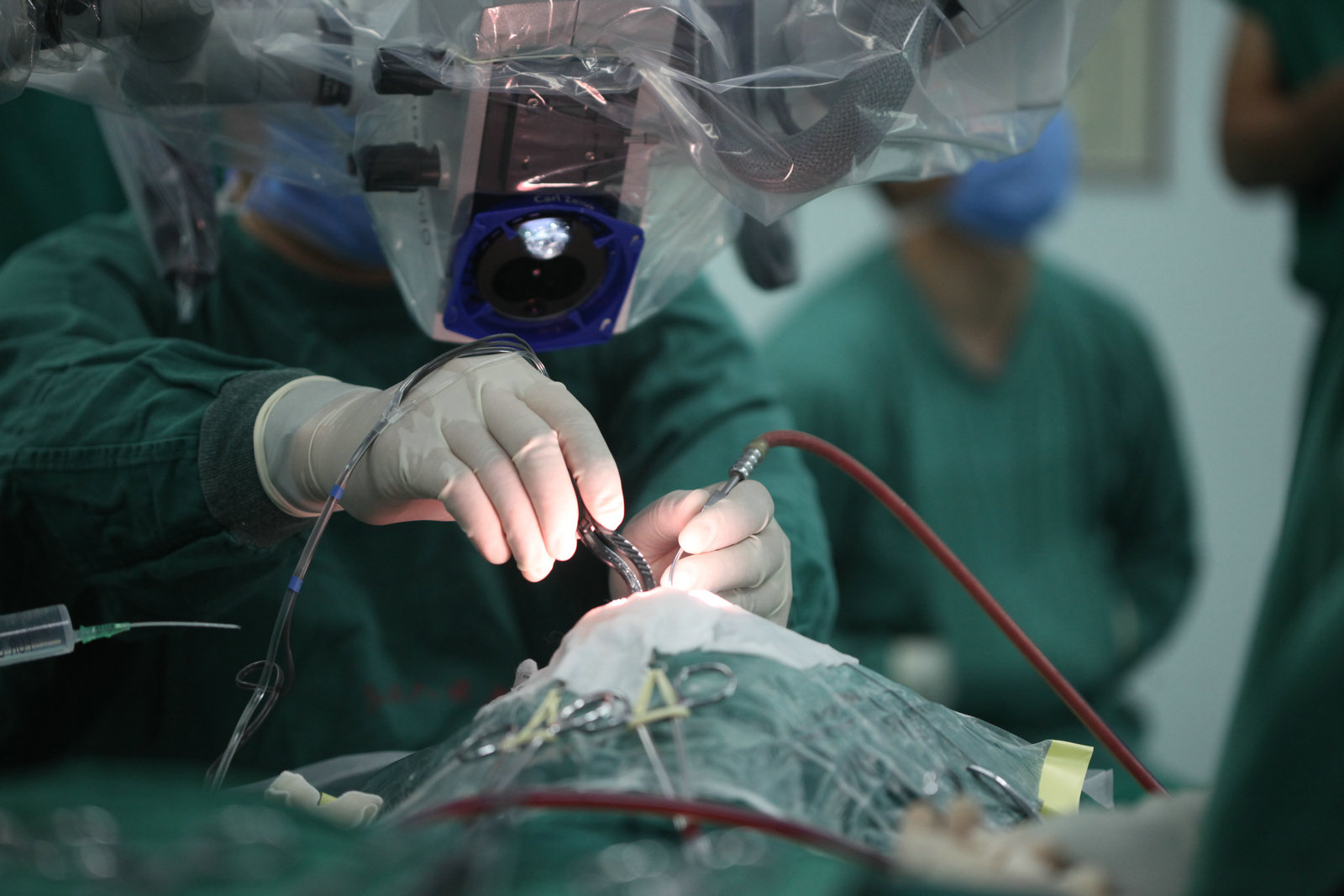 神经外科纪实视频,显微神经外科手术费用