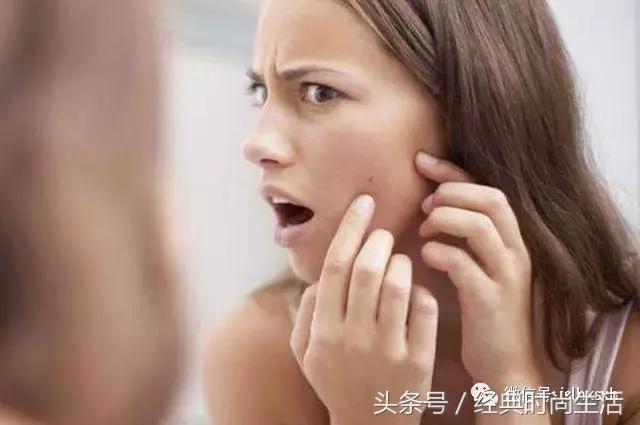 长痘痘不能吃啥,长痘痘能不能吃辣
