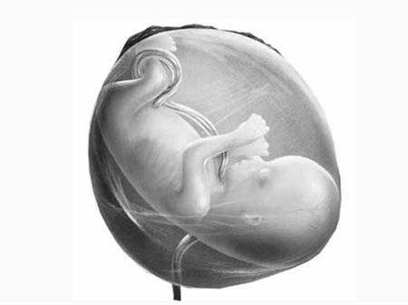 球拍状胎盘的孕妇要注意什么,球拍状胎盘会导致胎盘早剥吗