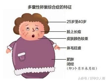 多囊备孕要吃多久的二甲双胍,多囊备孕整整五年了