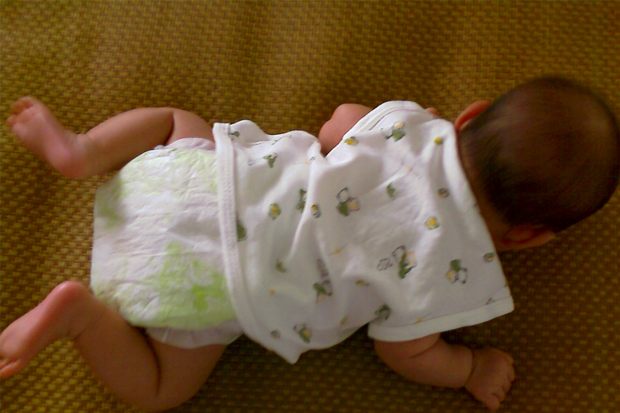 宝宝头垢清理完抹什么药,宝宝洗头垢的方法