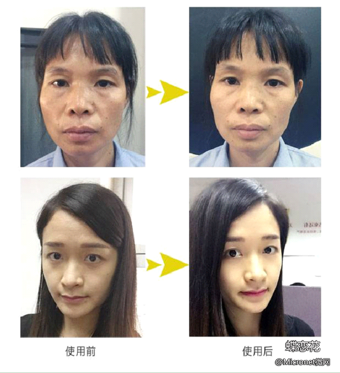 臻靓微蛋白蕾丝面膜,臻靓保湿隐形面膜