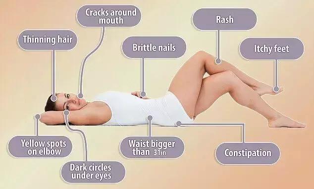 健康养生怎么调理便秘,科学运动改善便秘的方法