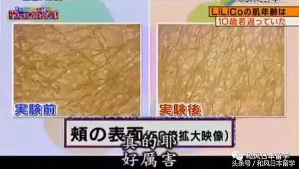 日本明星都在吃的胶原蛋白,日本真人秀吃胶原蛋白