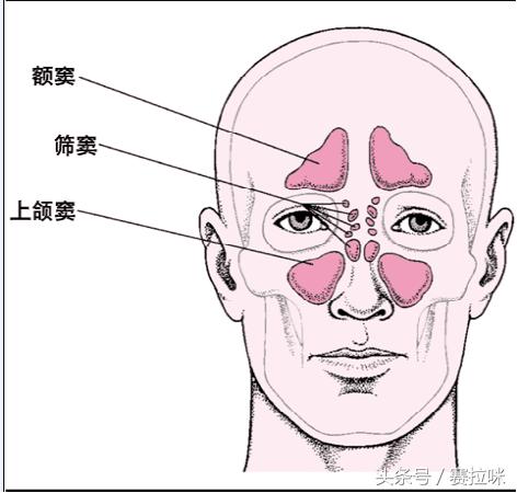 鼻炎怎么缓解鼻塞最有效,冬天鼻炎鼻塞严重堵塞无法呼吸