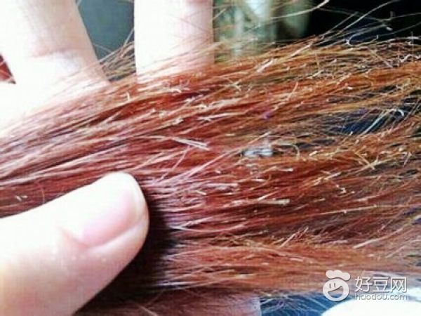 头发干枯毛糙开叉怎么护理,冬季头发干枯毛躁如何做