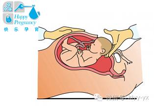 「分娩前后」头胎剖二胎想顺?看看您符合条件吗?