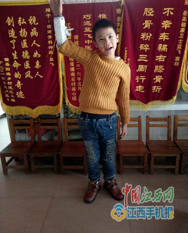龙南一男童不慎跌致骨折蓝飞中医敷药治愈